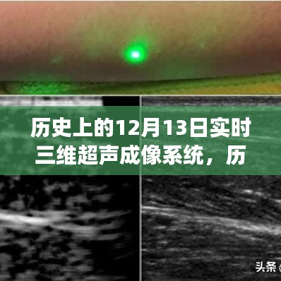 实时三维超声成像系统，诞生与演变历程的回顾