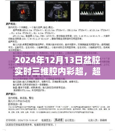盆腔实时三维腔内彩超，探索新知的奇妙之旅