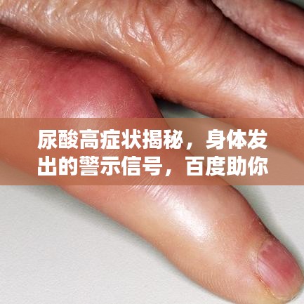 尿酸高症状揭秘，身体发出的警示信号，百度助你全面了解