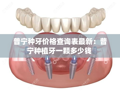 普宁种牙价格查询表最新：普宁种植牙一颗多少钱 