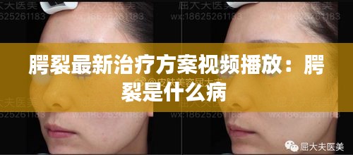 腭裂最新治疗方案视频播放：腭裂是什么病 