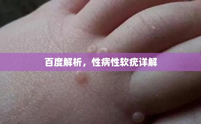 百度解析，性病性软疣详解
