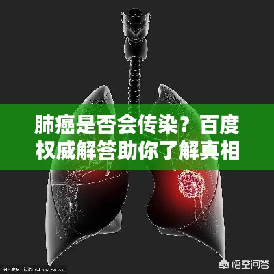 肺癌是否会传染？百度权威解答助你了解真相！