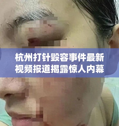 杭州打针毁容事件最新视频报道揭露惊人内幕