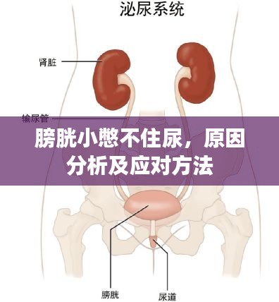 膀胱小憋不住尿，原因分析及应对方法